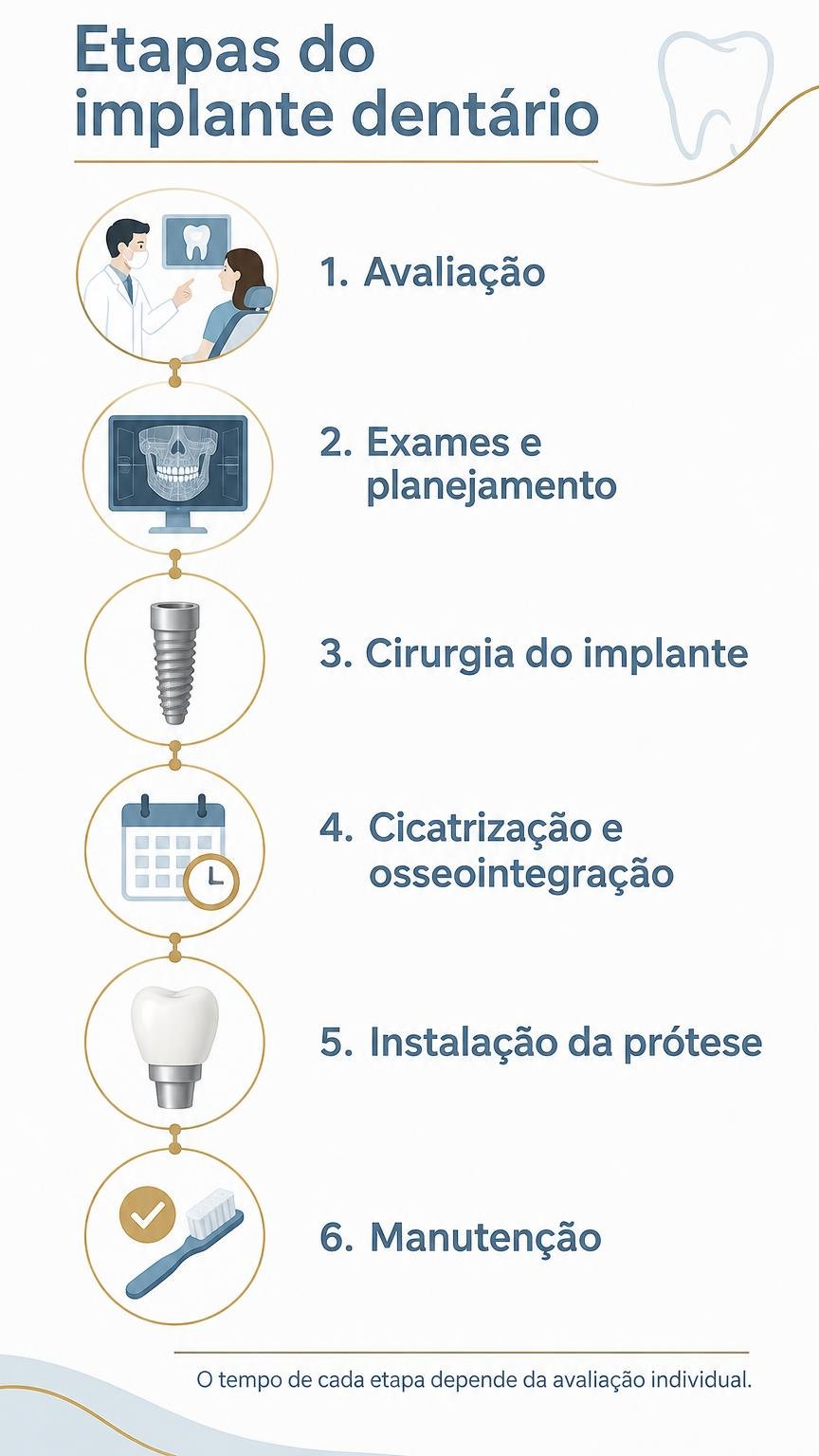 Infográfico das seis etapas principais: avaliação, exames e planejamento, cirurgia, cicatrização e osseointegração, prótese e manutenção